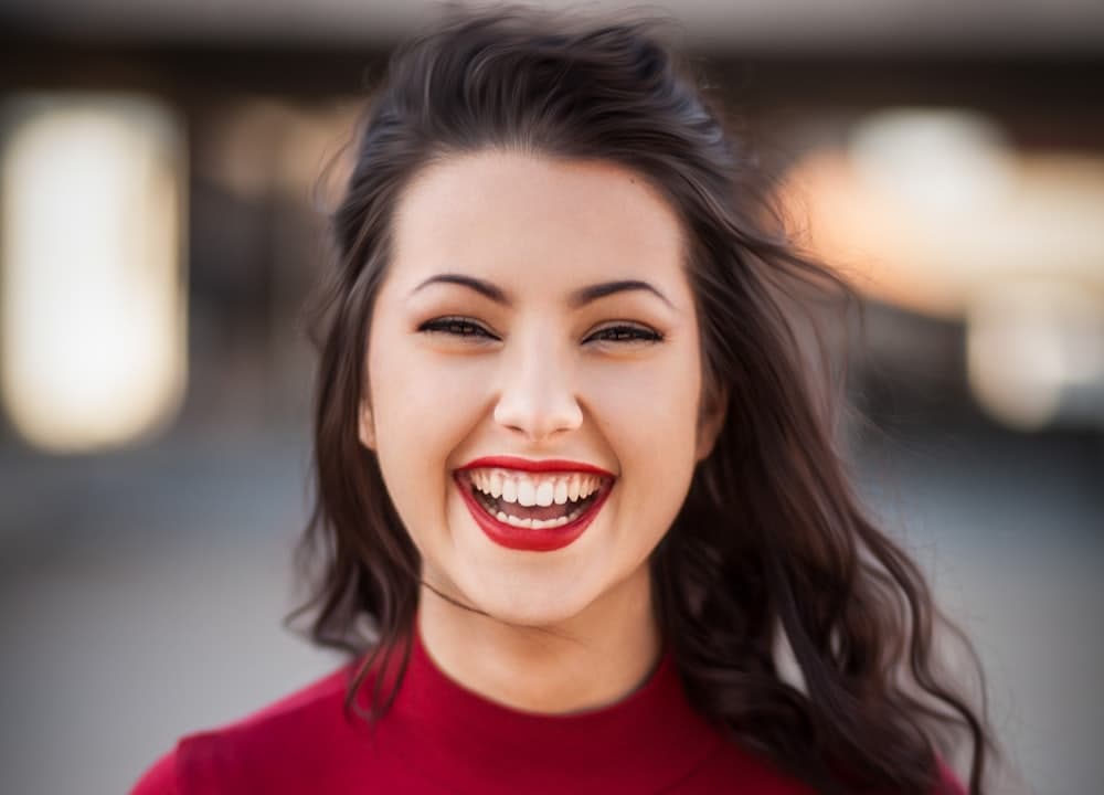 Sonrisa con dientes blancos tras un blanqueamiento dental